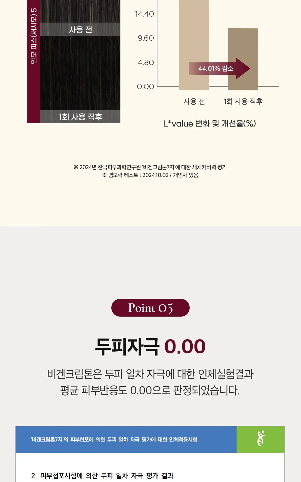 비겐크림톤 상세 설명