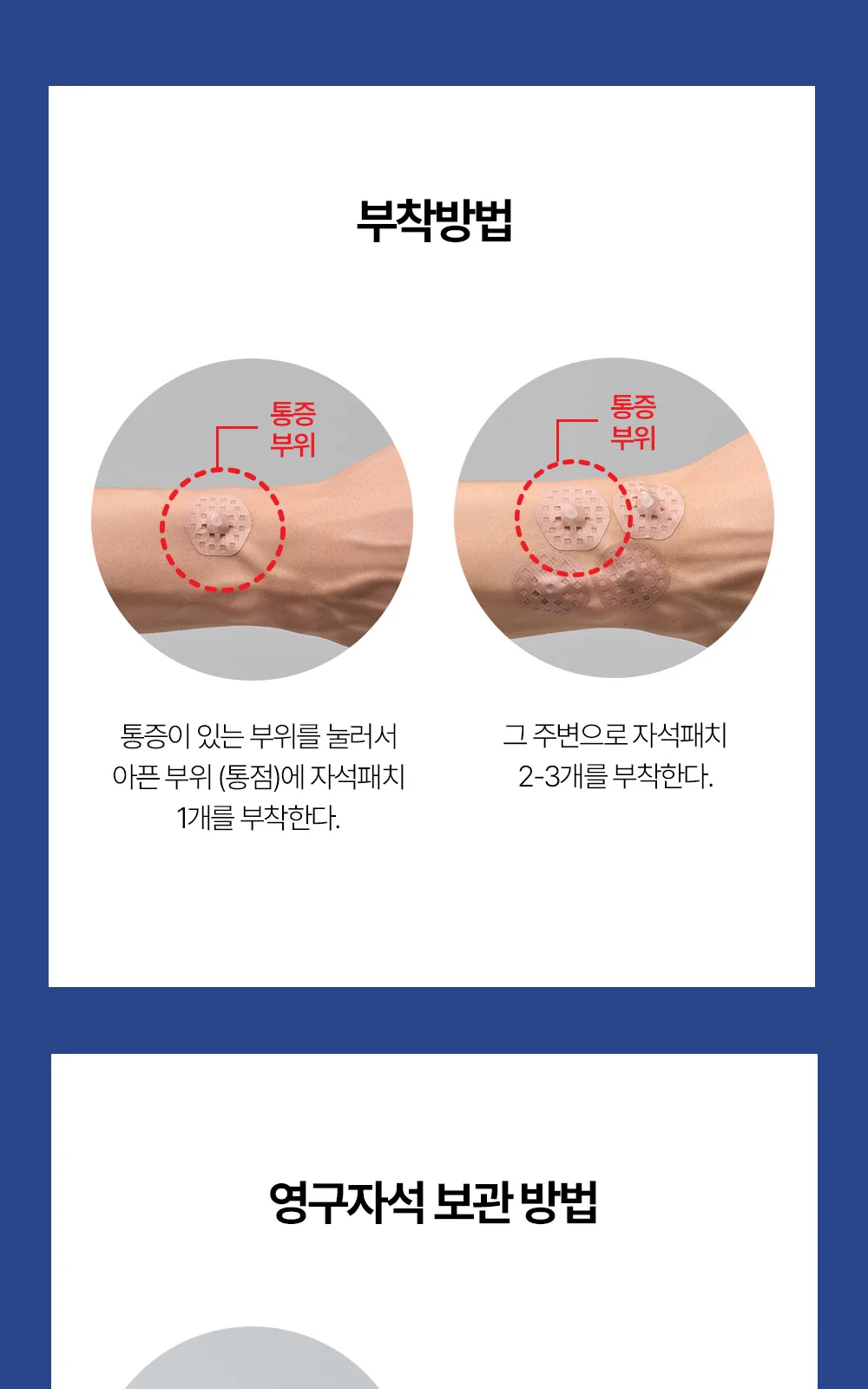 MK6 테이핑 자석패치 싱글형 114매 상세 설명