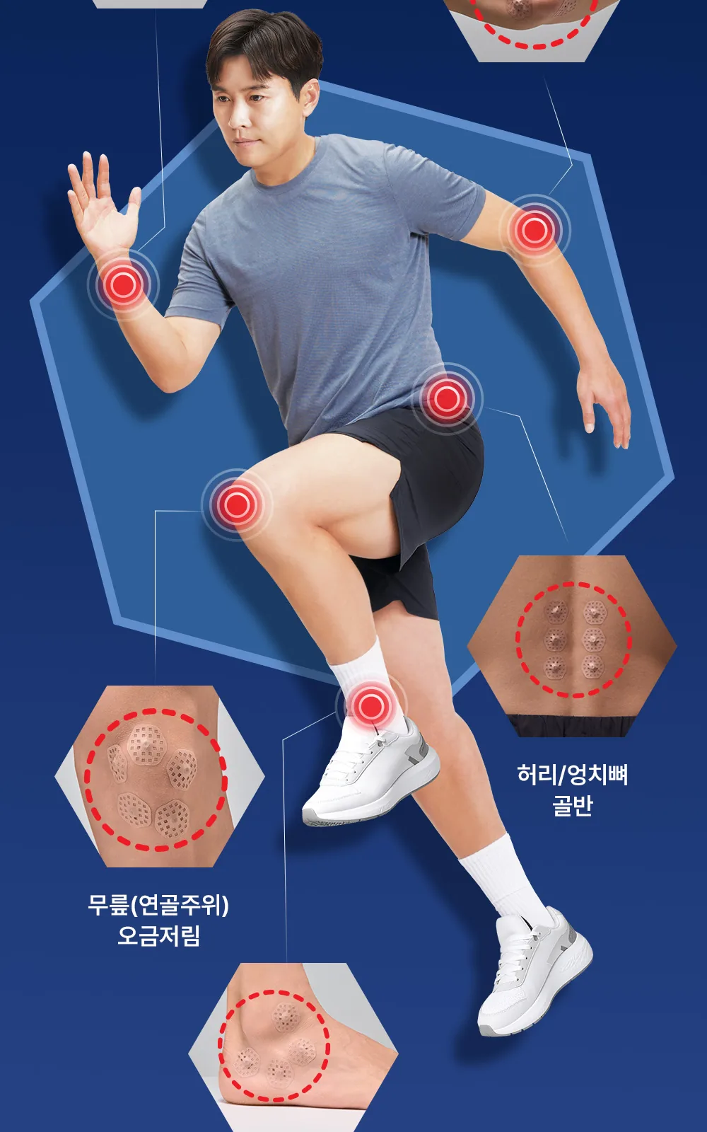 MK6 테이핑 자석패치 싱글형 114매 상세 설명