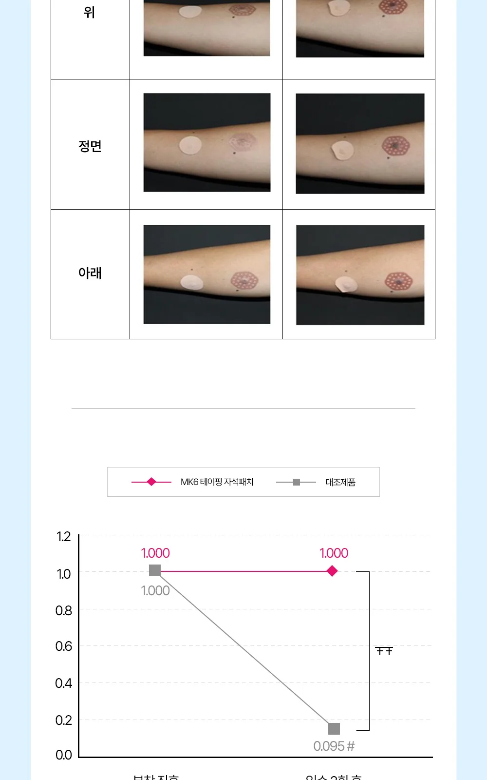 MK6 테이핑 자석패치 더블형 상세 설명