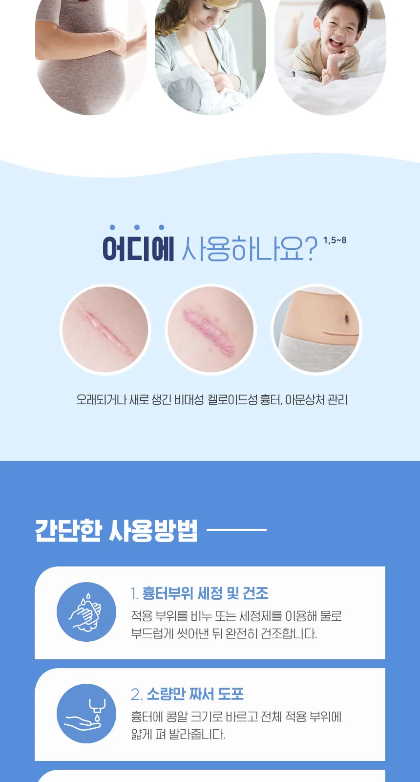 더마틱스울트라 15g 상세 설명
