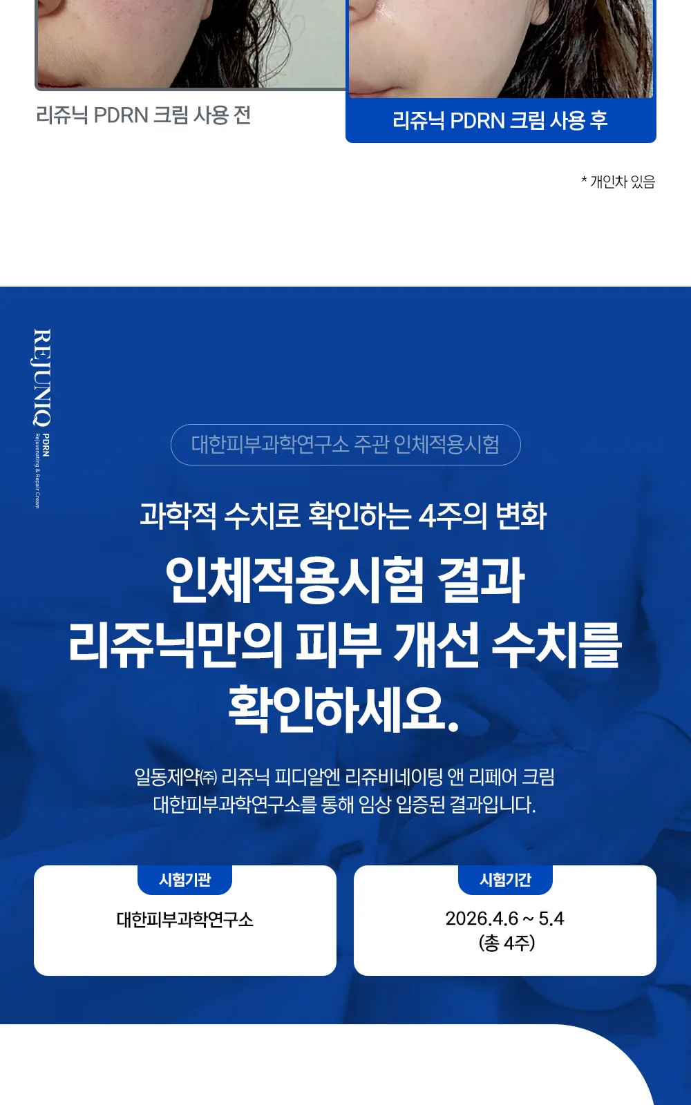 리쥬닉 피디알엔 크림 20ml 상세 설명